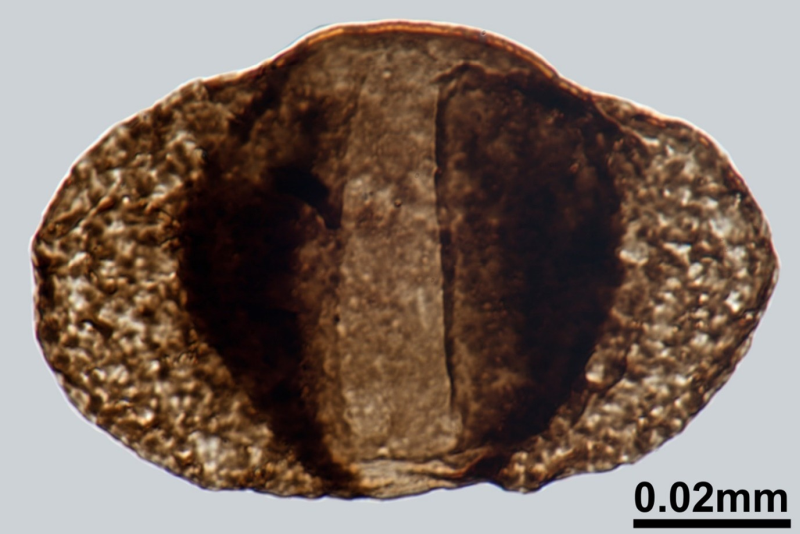 Microscopic pollen shed by the Dicroidium plant (scale bar = 0.02 mm)